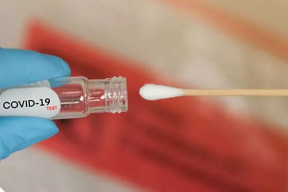 77163-reporte-covid-19-del-19-de-julio