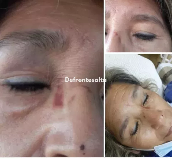 El rostro con hematomas  de la damnificada 