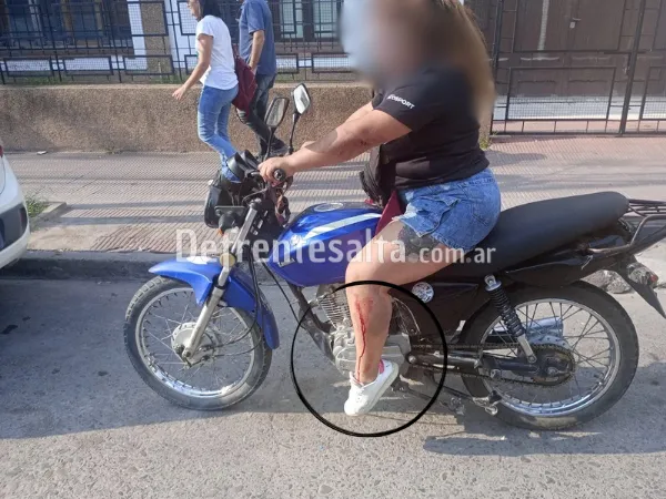 La mujer lesionada.