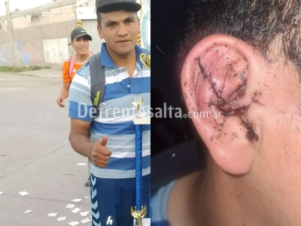 Los fruteros que se enfrentaron en la vía pública.