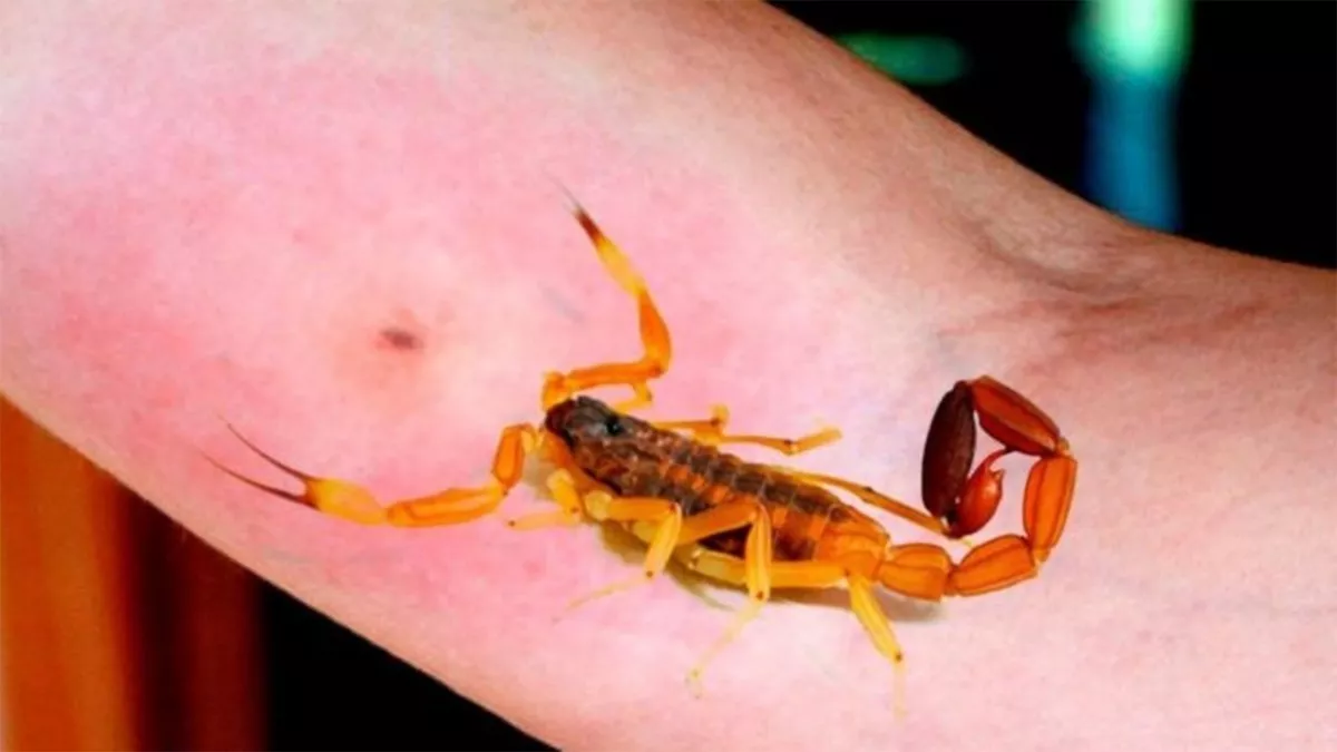 Alacranes