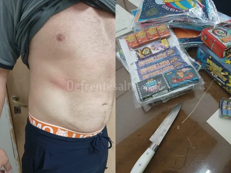 El inspector agredido. 