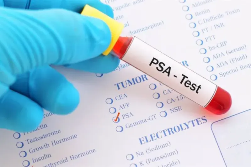 Detección del cáncer de próstata