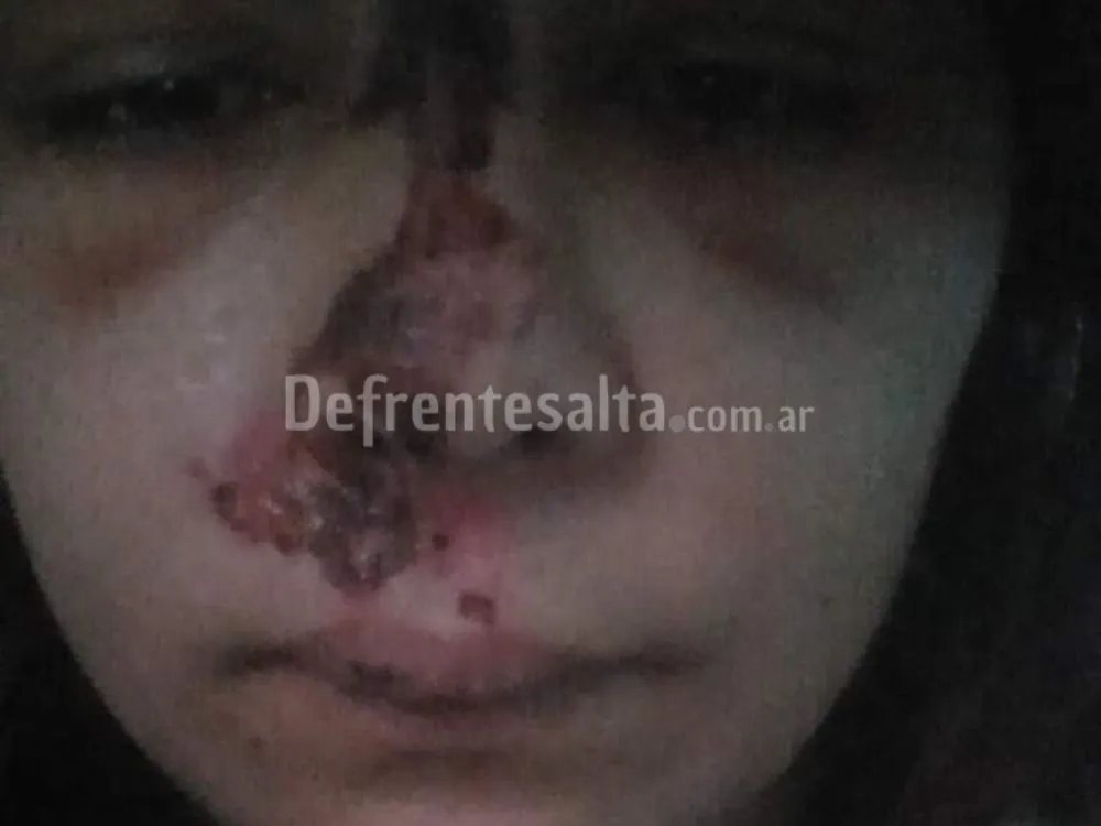 El rostro de la mujer damnificada.